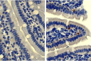 Paraffin embedded mouse small intestine section was stained with Rat Anti-Mouse IgD-UNLB followed by an HRP conjugated secondary antibody, DAB, and hematoxylin. (Rat anti-Mouse IgD Antibody)