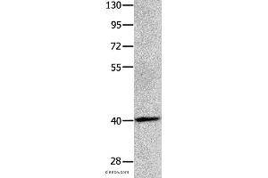 Western blot analysis of Human brain glioma tissue, using MAGEB4 Polyclonal Antibody at dilution of 1:550