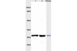 Lane 1: mouse liver lysates Lane 2: mouse brain lysates probed with Anti MS4A2 Polyclonal Antibody, Unconjugated (ABIN1715142) at 1:200 in 4 °C.