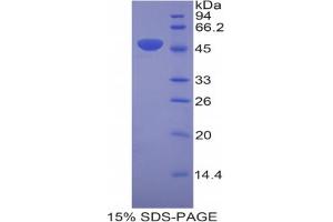 SDS-PAGE analysis of Mouse Laminin gamma 2 Protein.