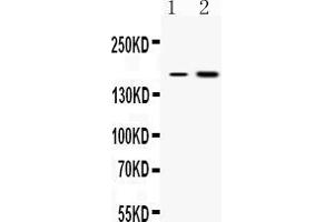 Western blot analysis of CSB expression in rat liver extract ( Lane 1) and COLO320 whole cell lysates ( Lane 2). (ERCC6 antibody  (N-Term))