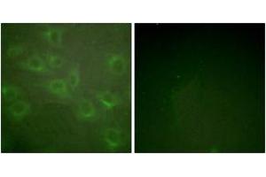 Immunofluorescence analysis of HuvEc cells, using Kv1. (KCNA3 antibody  (pTyr135))