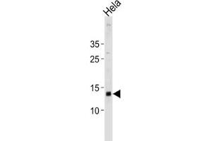 Western Blotting (WB) image for anti-Death-Associated Protein (DAP) antibody (ABIN3004644)