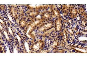 Detection of OLFM4 in Rat Kidney Tissue using Polyclonal Antibody to Olfactomedin 4 (OLFM4) (Olfactomedin 4 antibody  (AA 405-511))