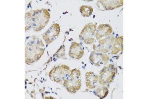 Immunohistochemistry of paraffin-embedded human stomach using USH1C antibody (ABIN5972448) at dilution of 1/100 (40x lens). (USH1C antibody)