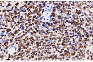 Immunohistochemistry of paraffin-embedded Rat spleen using MonoMethyl-Histone H3-K4 Polyclonal Antibody at dilution of 1:200 (40x lens). (Histone 3 antibody  (meLys4))