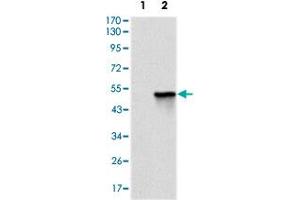 Western blot analysis using TNNI2 monoclonal antobody, clone 2F12G2  against HEK293 (1) and TNNI2 (aa1-182)-hIgGFc transfected HEK293 (2) cell lysate.