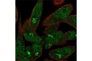 Immunofluorescent staining of RH-30 cell line with antibody shows positivity in nucleoplasm and the Golgi apparatus (green). (USP33 antibody)