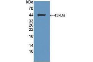 Detection of Recombinant BCAN, Mouse using Polyclonal Antibody to Brevican (BCAN) (BCAN antibody  (AA 23-353))
