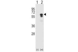 Western blot analysis of ALK2 antibody and 293 cell lysate (2 ug/lane) either nontransfected (Lane 1) or transiently transfected (2) with the ACVR1 gene.
