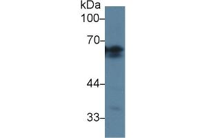 Western Blotting (WB) image for anti-Angiotensinogen (serpin Peptidase Inhibitor, Clade A, Member 8) (AGT) (AA 25-477) antibody (ABIN7432631)