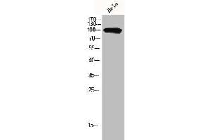 Western Blot analysis of Hela cells using GCN5 Polyclonal Antibody (KAT2A antibody  (C-Term))