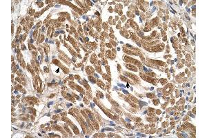 SLC17A5 antibody was used for immunohistochemistry at a concentration of 4-8 ug/ml to stain Skeletal muscle cells (arrows) in Human Muscle. (Solute Carrier Family 17 (Acidic Sugar Transporter), Member 5 (SLC17A5) antibody)