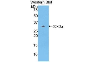 Western blot analysis of the recombinant protein. (IFNAR1 antibody  (AA 244-512))