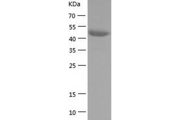 SMAD2 Protein (AA 2-467) (His tag)