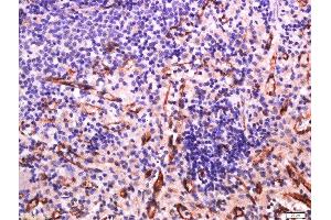Formalin-fixed and paraffin embedded rat spleen labeled with Anti-Sialoadhesin Polyclonal Antibody, Unconjugated  at 1:500 followed by conjugation to the secondary antibody and DAB staining.