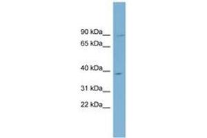 Image no. 1 for anti-Enkurin Domain Containing 1 (ENKD1) (C-Term) antibody (ABIN6742123) (ENKD1 antibody  (C-Term))