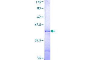 POLR3A Protein (AA 111-209) (GST tag)