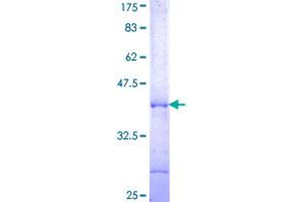 POLR3A Protein (AA 111-209) (GST tag)