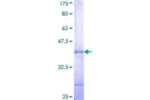 POLR3A Protein (AA 111-209) (GST tag)