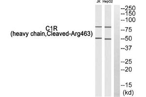 Western blot analysis of extracts from Jurkat cells and HepG2 cells, using C1R (heavy chain, Cleaved-Arg463) antibody. (C1R antibody  (Cleaved-Arg463, Heavy Chain))