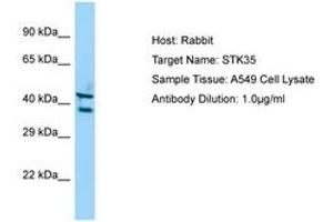 Image no. 1 for anti-Serine/threonine Kinase 35 (STK35) (C-Term) antibody (ABIN6750140) (STK35 antibody  (C-Term))
