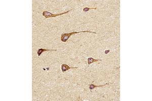 Antibody staining EREG in Human brain tissue sections by Immunohistochemistry (IHC-P - paraformaldehyde-fixed, paraffin-embedded sections). (Epiregulin antibody  (C-Term))