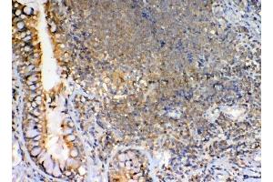 IHC analysis of GRK2 using anti-GRK2 antibody (ABIN5693069). (GRK2 antibody)