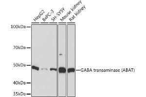 Western blot analysis of extracts of various cell lines, using GABA transaminase (GABA transaminase (ABAT)) Rabbit mAb (ABIN7265336) at 1:1000 dilution. (ABAT antibody)