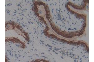 IHC-P analysis of Mouse Vas Deferens Tissue, with DAB staining. (Thymic Stromal Lymphopoietin antibody  (AA 21-138))