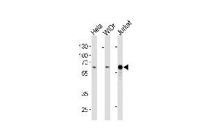 HDAC1 Antibody (ABIN1882195 and ABIN2843403) western blot analysis in Hela,WiDr,Jurkat cell line lysates (35 μg/lane). (HDAC1 antibody)