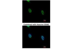 ICC/IF Image Immunofluorescence analysis of paraformaldehyde-fixed HeLa, using hnRNP K, antibody at 1:500 dilution. (HNRNPK antibody)