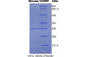 SDS-PAGE of Protein Standard from the Kit (Highly purified E. (COMP ELISA Kit)