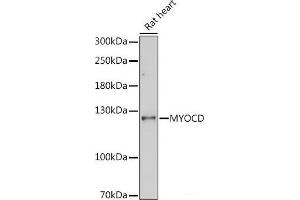 Western blot analysis of extracts of Rat heart using MYOCD Polyclonal Antibody at dilution of 1:1000. (Myocardin antibody)