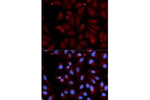 Immunofluorescence analysis of U2OS cell using MAOB antibody. (Monoamine Oxidase B antibody)