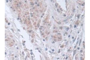 Immunohistochemistry (IHC) image for anti-Stress-Induced-phosphoprotein 1 (STIP1) (AA 1-169) antibody (ABIN7436411)