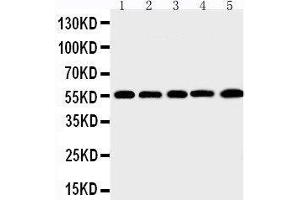 Anti-MMP12 antibody, Western blotting Lane 1: SMMC Cell Lysate Lane 2: HEPA Cell Lysate Lane 3: HELA Cell Lysate Lane 4: K562 Cell Lysate Lane 5: MCF-7 Cell Lysate (MMP12 antibody  (C-Term))