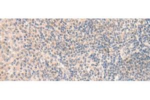 Immunohistochemistry of paraffin-embedded Human tonsil tissue using GRM2 Polyclonal Antibody at dilution of 1:50(x200) (GRM2 antibody)