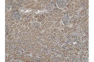 Immunohistochemistry (IHC) image for anti-Vacuolar Protein-Sorting-Associated Protein 25 (VPS25) (Internal Region) antibody (ABIN185544)