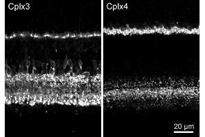 Indirect immunostaining of mouse retina with rabbit polyclonal antibodies against complexin 3 (cat.
