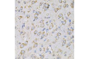Immunohistochemistry of paraffin-embedded rat brain using IL10RA Antibody (ABIN3022614, ABIN3022615, ABIN3022616, ABIN1513078 and ABIN6218954) at dilution of 1:100 (40x lens). (IL-10RA antibody  (AA 22-230))