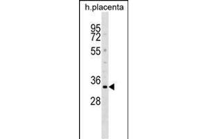 DOK5 Antibody (N-term) (ABIN1539174 and ABIN2848803) western blot analysis in human placenta tissue lysates (35 μg/lane). (DOK5 antibody  (N-Term))