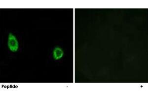Immunofluorescence analysis of HUVEC cells, using CHST9 polyclonal antibody . (CHST9 antibody)