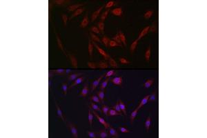 Immunofluorescence analysis of NIH/3T3 cells using FGF23 antibody (ABIN6127894, ABIN6140600, ABIN6140602 and ABIN6221721) at dilution of 1:25. (FGF23 antibody  (AA 25-251))