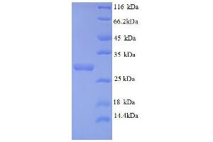 SDS-PAGE (SDS) image for Androgen-Induced 1 (AIG1) (AA 60-87), (partial) protein (GST tag) (ABIN1046524) (AIG1 Protein (AA 60-87, partial) (GST tag))