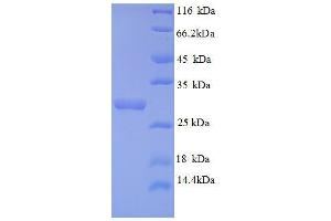 SDS-PAGE (SDS) image for Androgen-Induced 1 (AIG1) (AA 60-87), (partial) protein (GST tag) (ABIN1046524)