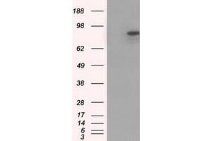 HEK293T cells were transfected with the pCMV6-ENTRY control (Left lane) or pCMV6-ENTRY CDH13 (Right lane) cDNA for 48 hrs and lysed. (Cadherin 13 antibody)