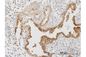 Immunoperoxidase of monoclonal antibody to ANXA4 on formalin-fixed paraffin-embedded human endometrium. (Annexin IV antibody  (AA 1-321))