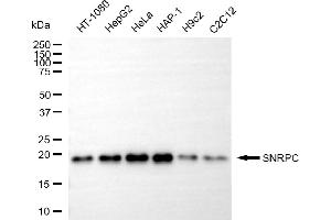 anti-Small Nuclear Ribonucleoprotein Polypeptide C (SNRPC) antibody