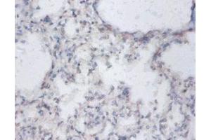 Immunohistochemistry of paraffin-embedded human lung tissue using ABIN7149863 at dilution of 1:100 (SAT1 antibody  (AA 5-171))